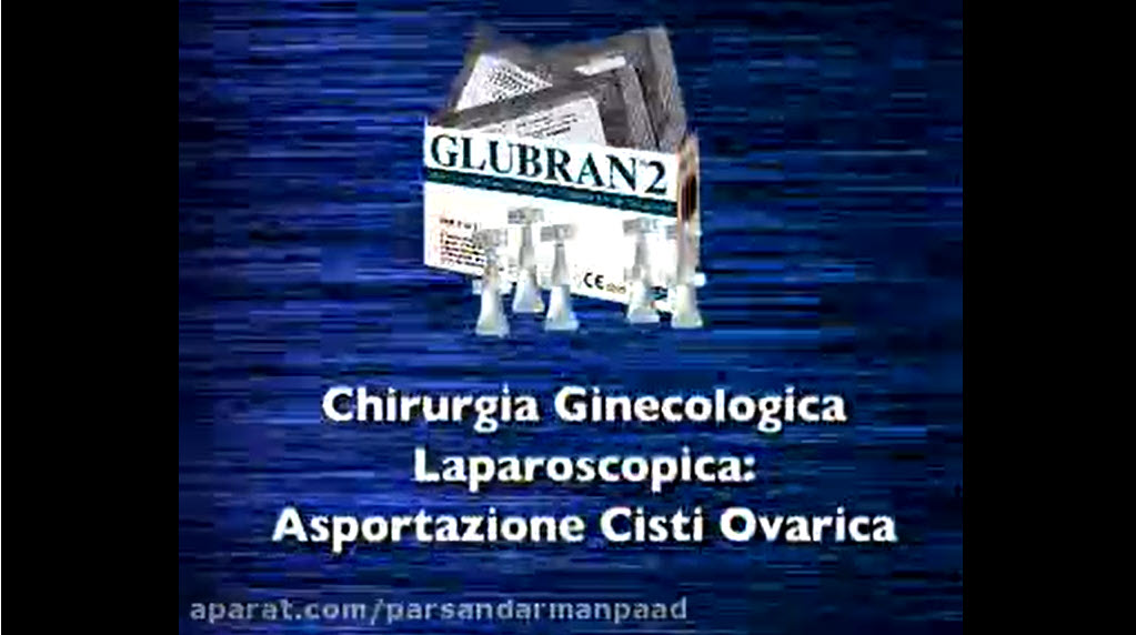 فیلم جراحی لاپاراسکوپی GYN با گلوبرن 2