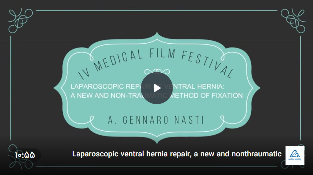 فیلم ترمیم فتق شکمی به شیوه لاپاراسکوپی با چسب جراحی گلوبرن 2
