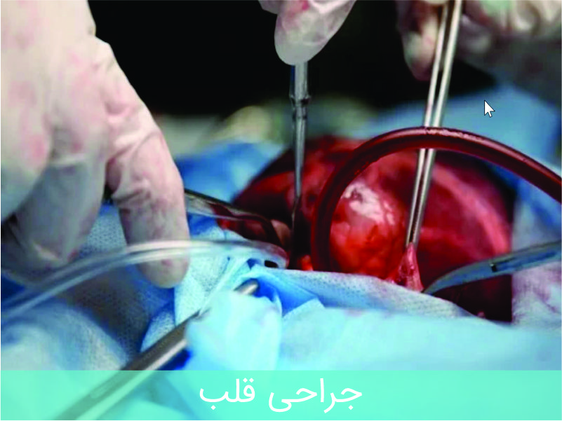 گلوبرن 2 - چسب سیانواکریلات پزشکی و جراحی - چسب فیستول - چسب واریس - چسب مایع جراحی